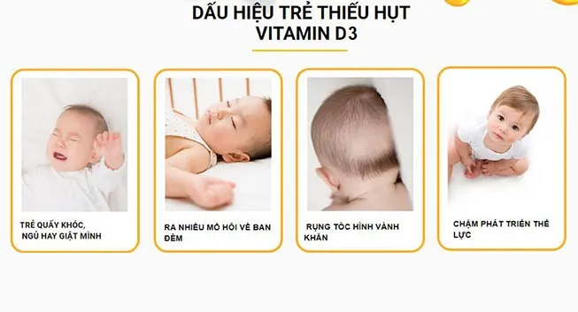 alt text: Hình ảnh trẻ bị rụng tóc vành khăn do thiếu vitamin D3