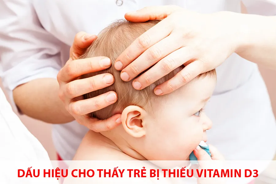 Bé bị rụng tóc