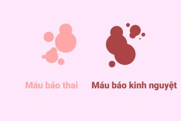 Hình ảnh minh họa thay đổi vùng ngực khi mang thai